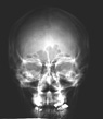 Radiograph of a human skull